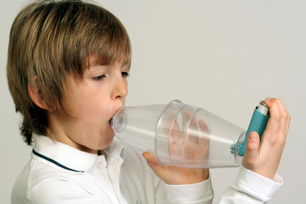 Allergic Asthma