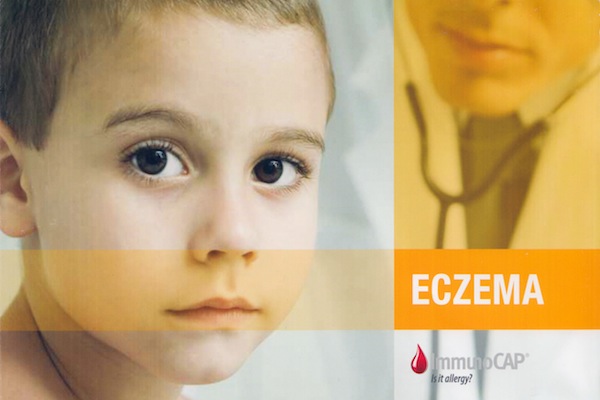 Eczemas